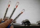 Satu Warga Jakarta Utara Diduga Terinfeksi Hantavirus
